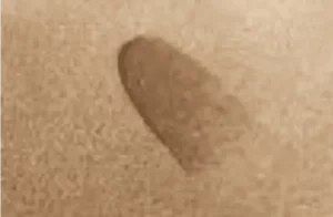 Floor burns | DeHaan Tile & Floor Covering